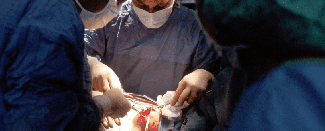 Will xenotransplantation address the human organs shortage?